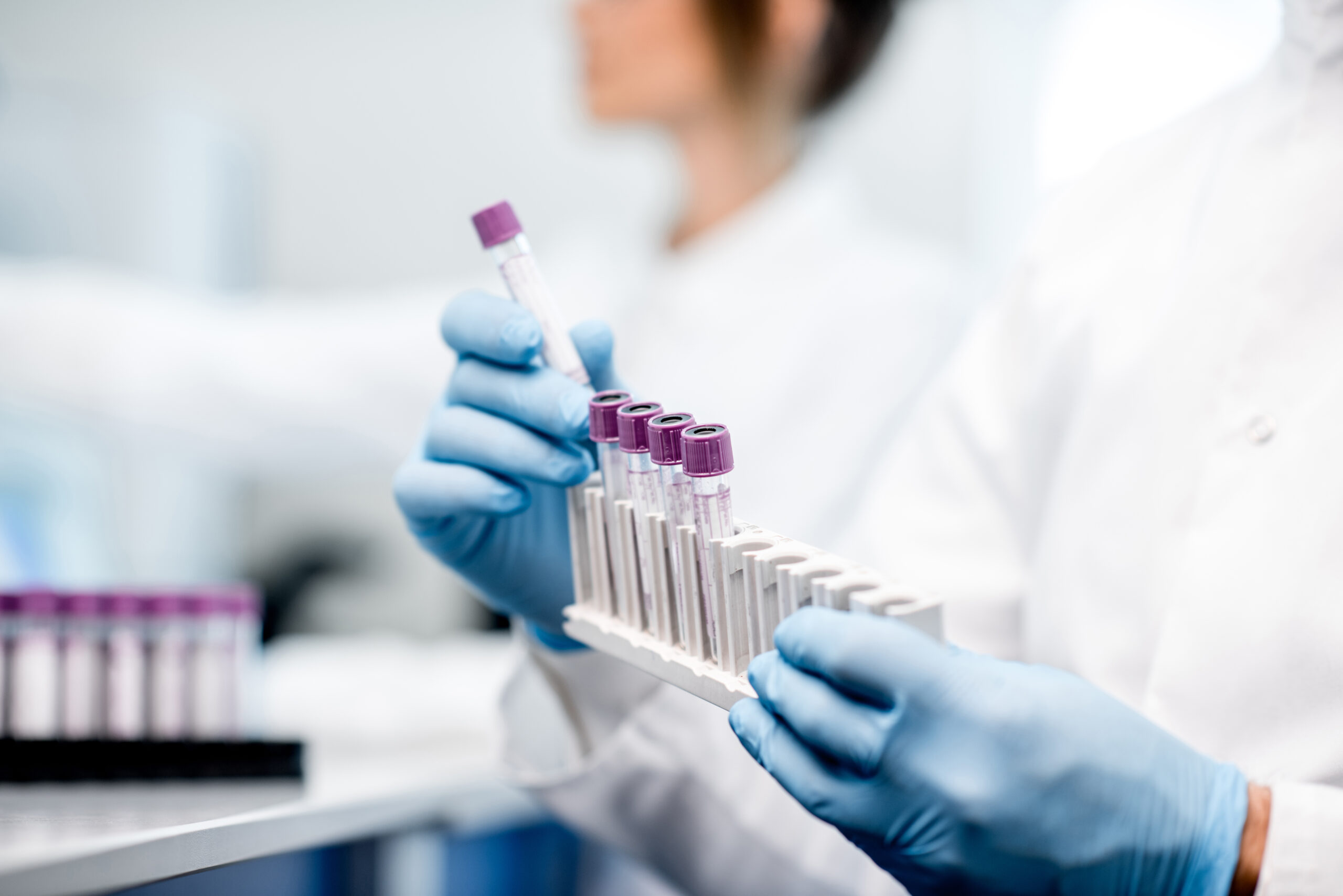 Impact of the Selective Orexin‐1 Receptor Antagonist ACT‐539313 on the Pharmacokinetics of the CYP3A Probe Drug Midazolam in Healthy Male Subjects