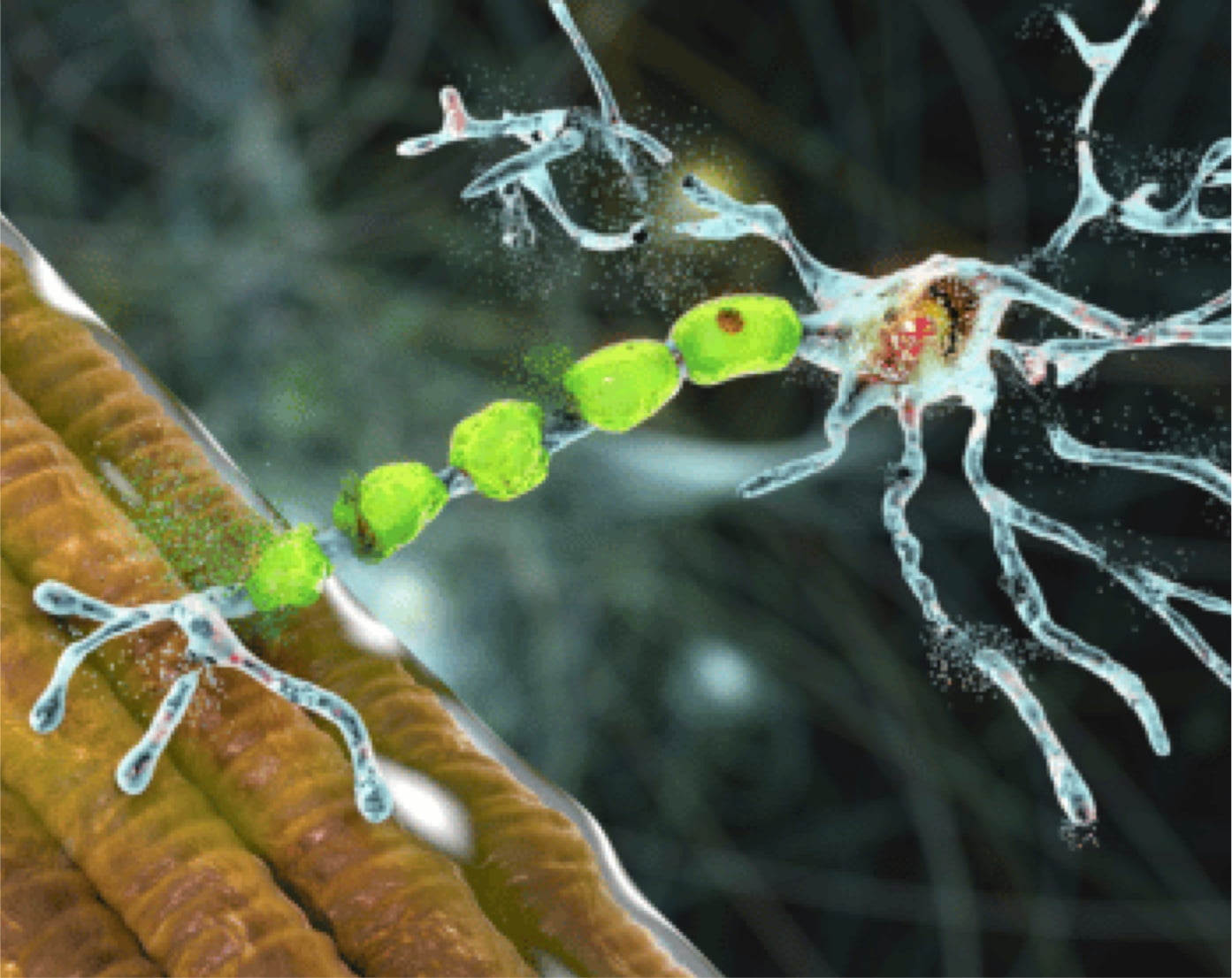 Amyotrophic Lateral Sclerosis (ALS) Guide