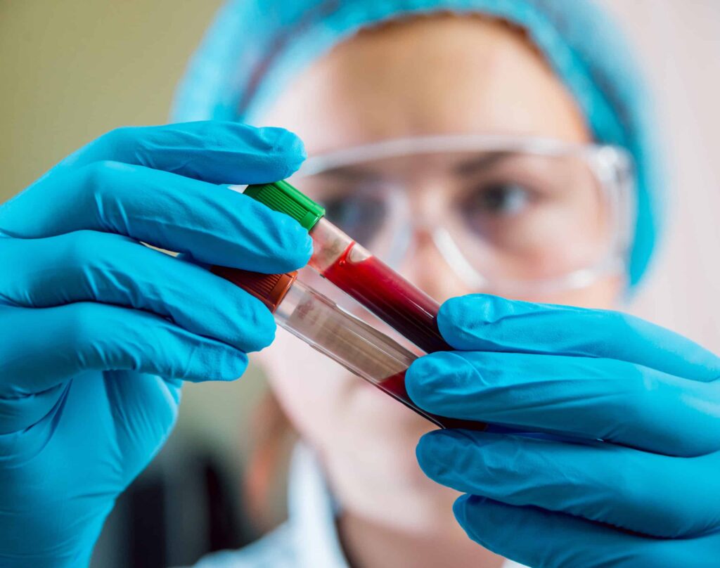 Scientist holding test tubes filled with blood