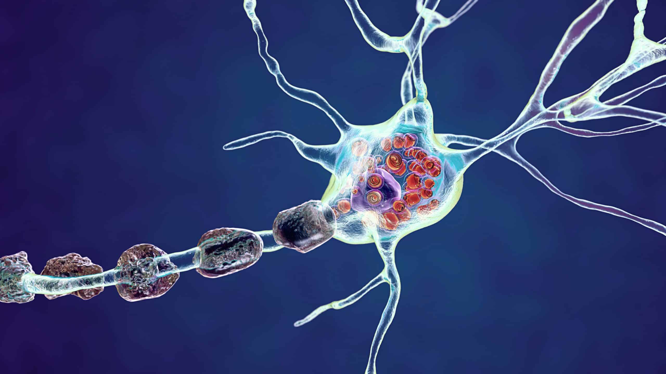 Rare Disease Day 2022: Niemann-Pick Disease