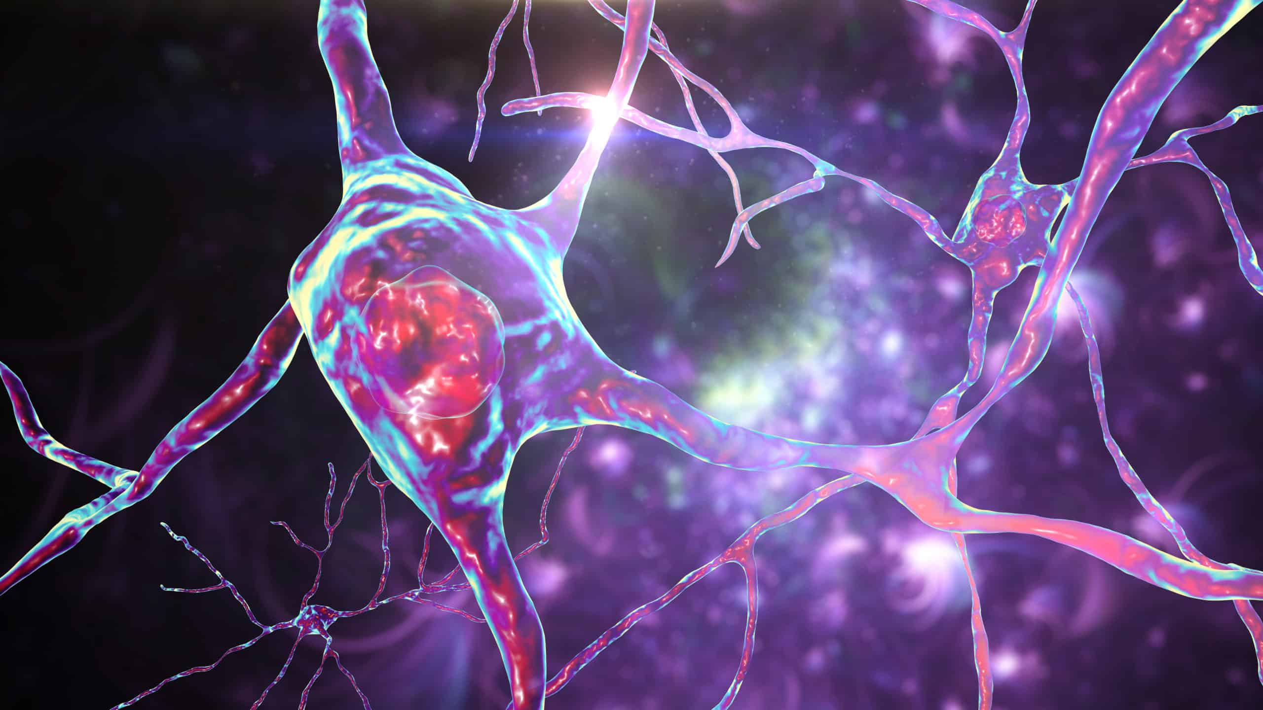 Rare Disease Day 2022: Huntington’s Disease