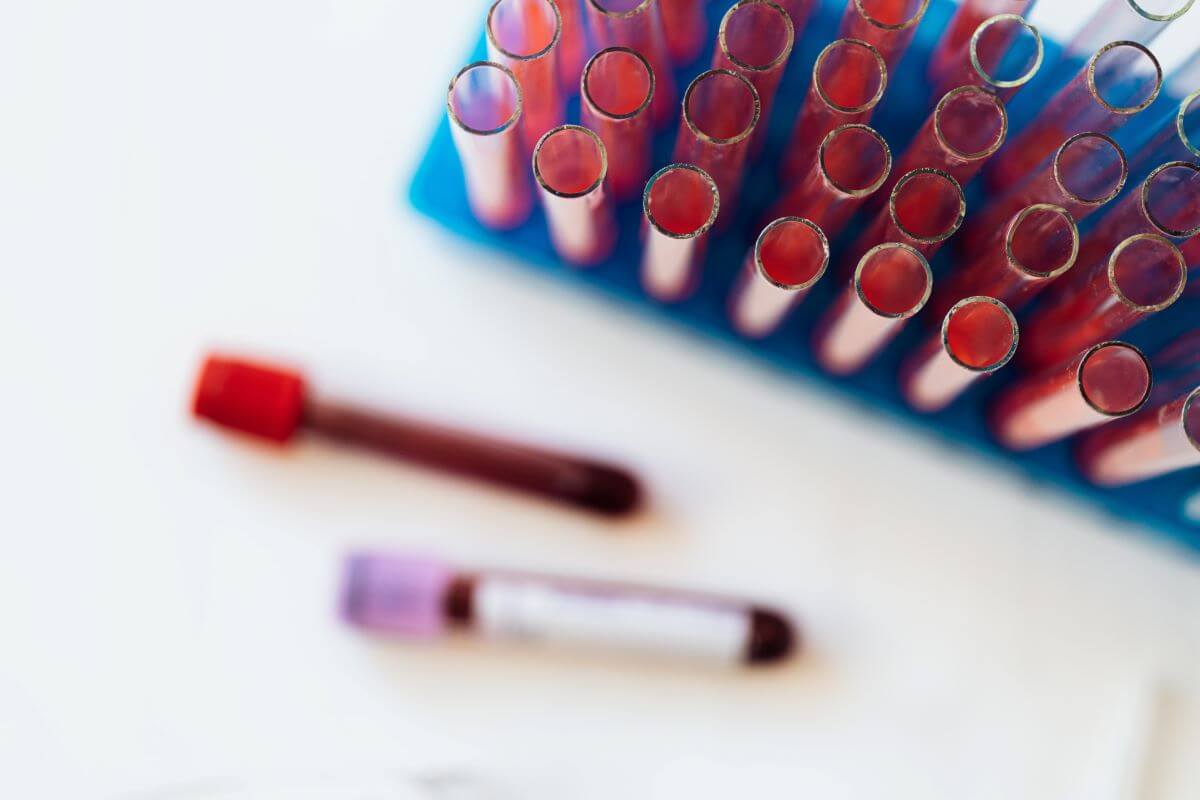 The 4 Types of clinical trial monitoring