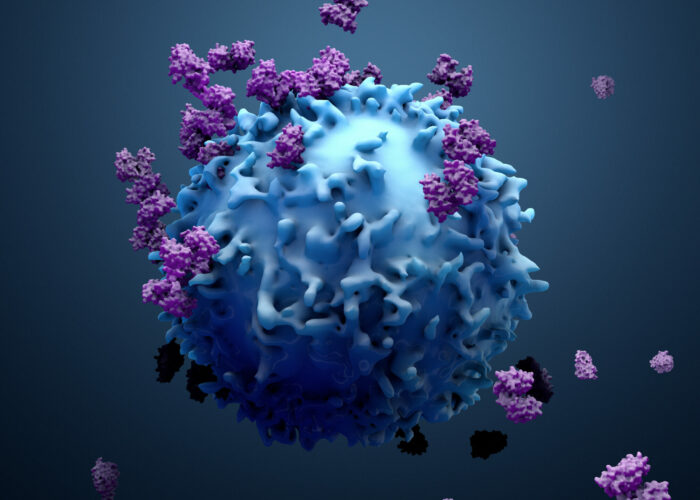 Chordoma rare oncology