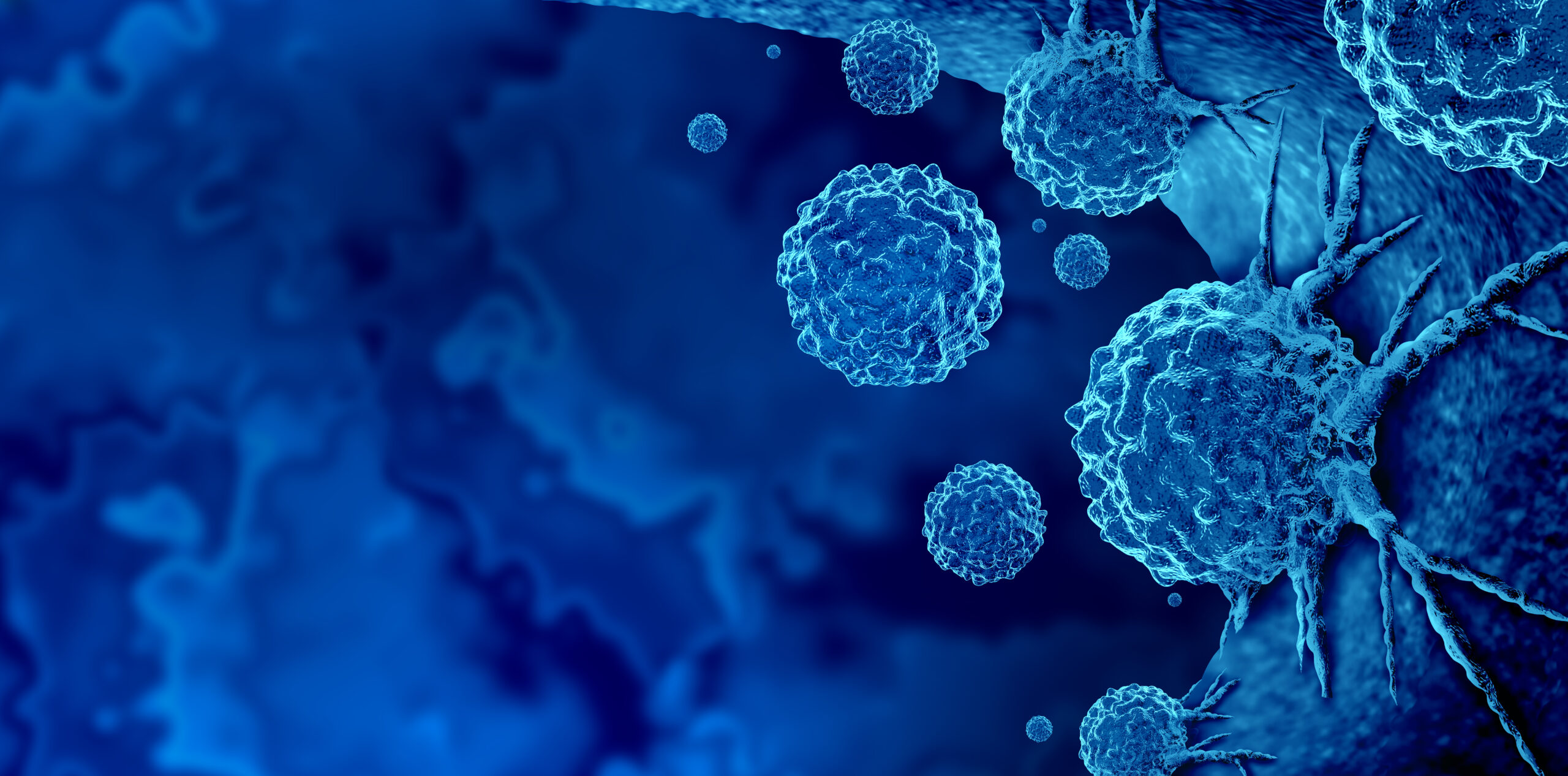 The Role of Imaging For Diagnosis & Assessment of Severe Asthma