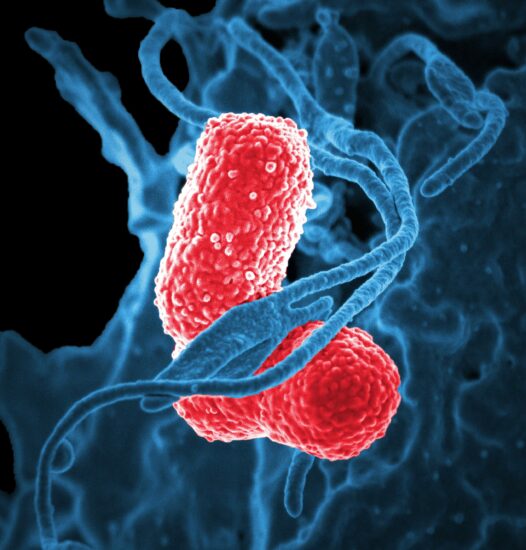Close up image of Disease (pneumonia)