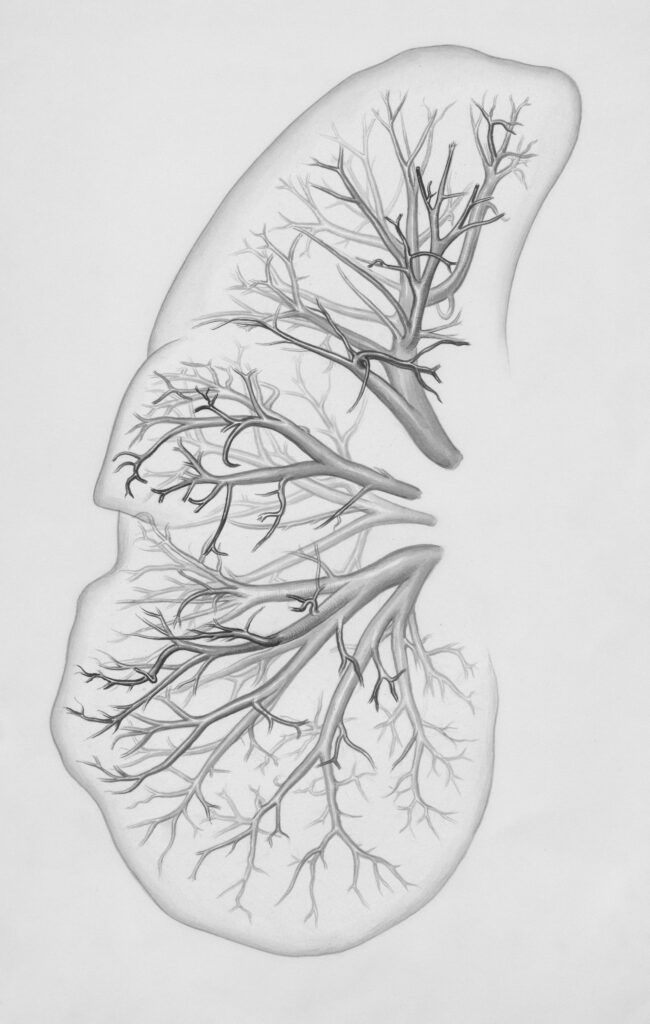 diagram of a lung (ILD)