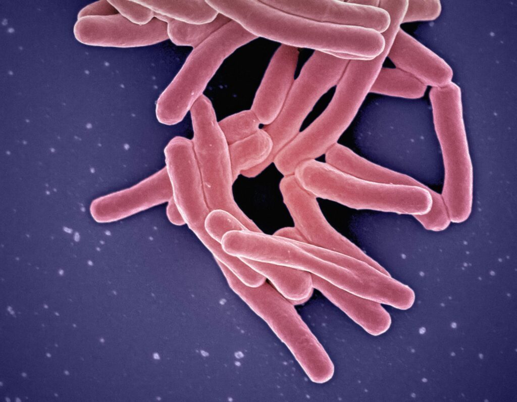 Close up image of TB