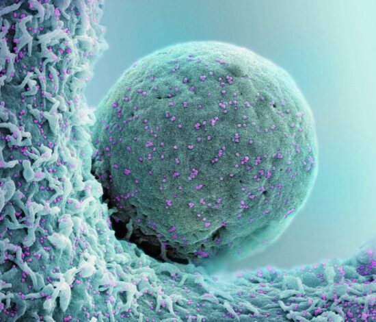 Cell and Gene therapy