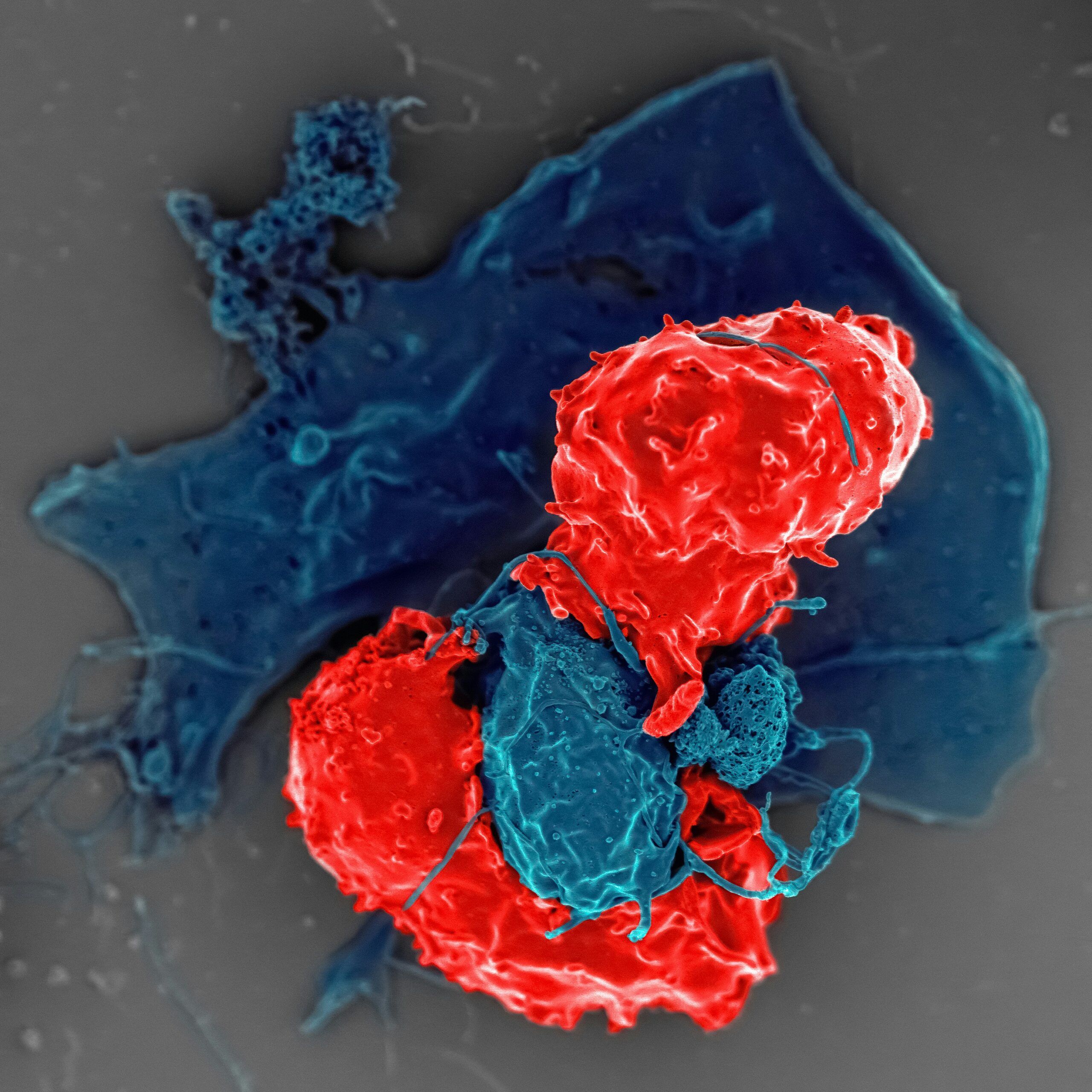 Primary Immunodeficiency: Symptoms, diagnoses and life expectancy 